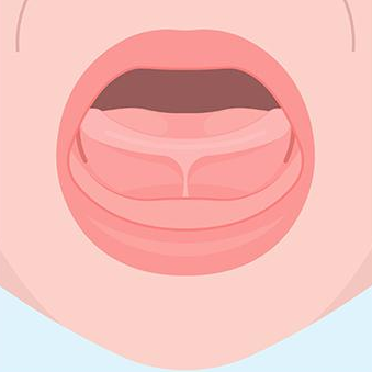 Laser Frenectomy | Tongue‑Tie & Lip‑Tie Release in Winnipeg