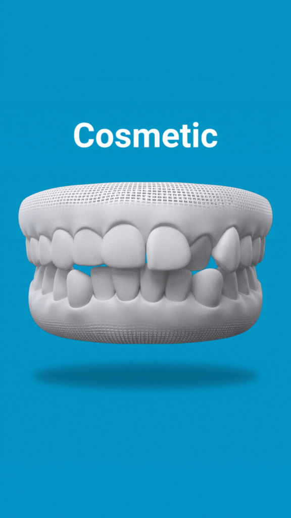 Invisalign cosmetic alterations