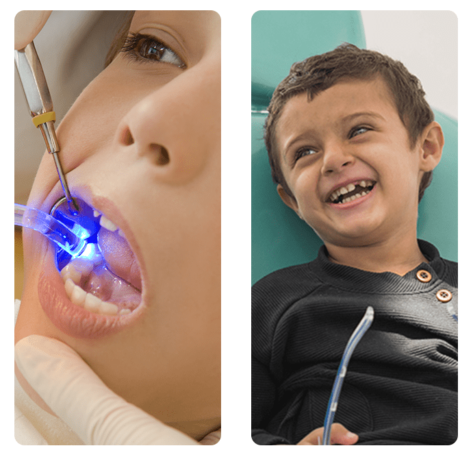 children's dental filling children's and kids dental filling Winnipeg
