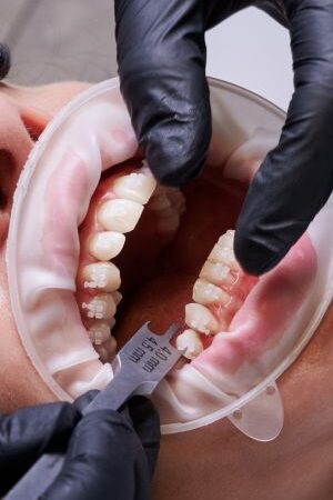 overcrowding overcrowding