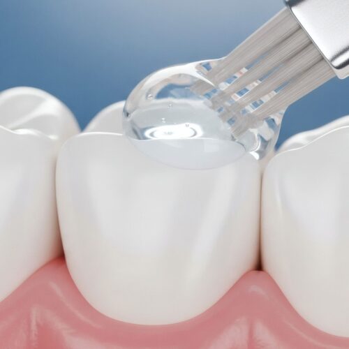 AdobeStock_1671315157-edit dental sealant and fluoride treatment at Greenwood's Pediatric Dentistry