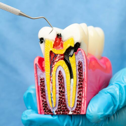 asian-dentist-holding-dental-implant-artificial-t-2025-02-25-02-00-54-utc pulp therapy for kids
