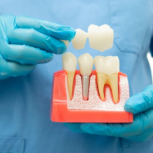 envato-labs-image-edit (14) Restorative dentistry for kids_Greenwoods dental