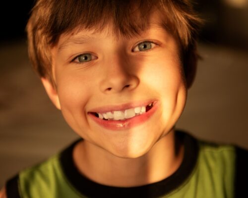 smiling kid with laser frenectomy done in greenwoods pediatric dentistry in Winnipeg